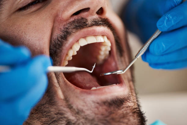 Professional Emergency Dental Service in SD