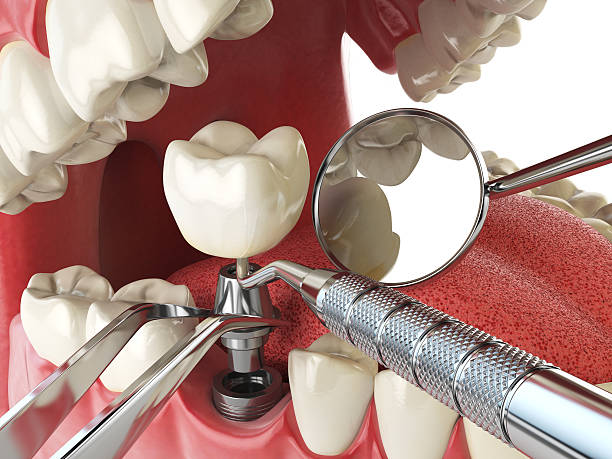 Best Broken or Chipped Tooth Repair in Agency Village, SD